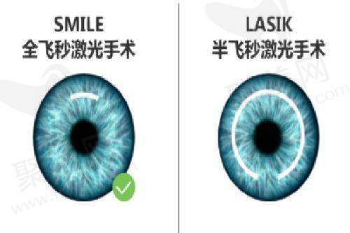 如何确定具体的手术费用
