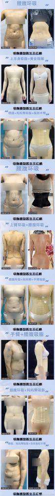 五、患者真实体验分享