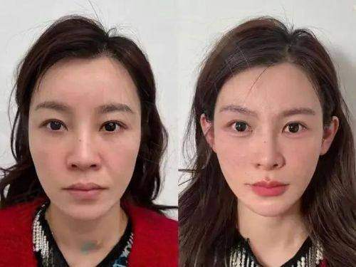 用户反馈对馒化针成效的支持