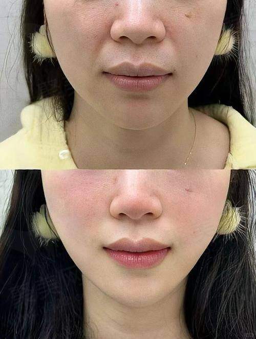 五、美学设计与风险提示