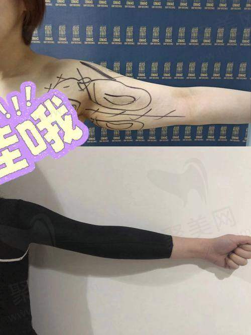 手臂粗壮怎么减更快瘦下来？快速瘦手臂的五个有效方法，轻松甩掉拜拜肉，告别粗胳膊，塑造纤细手臂！