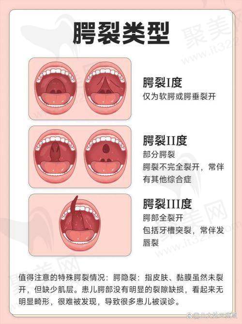 北京马群医生有哪些成功的唇腭裂修复实例？