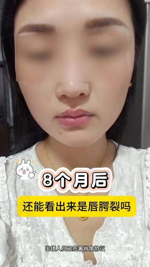 北京马群医生现在在哪个医院？在北京画美，如何预约她呢？