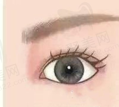 成都纯曦林靖内眼角修复1万元起，显微技术防增生，术后形态自然眼神亮