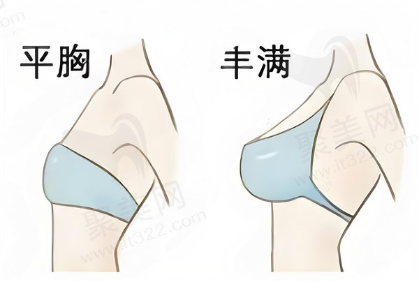 重庆曹勇丰胸的名气怎么样？专业背景、特色技术、高满意度与性价比揭秘