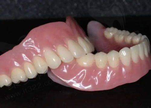 深圳登特口腔医院的收费贵吗？