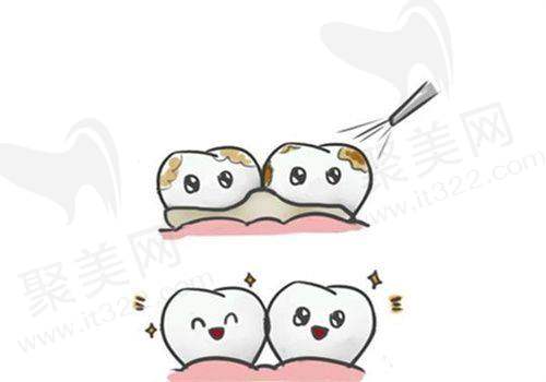 三、柳州华侨医院口腔科诊疗项目有哪些？