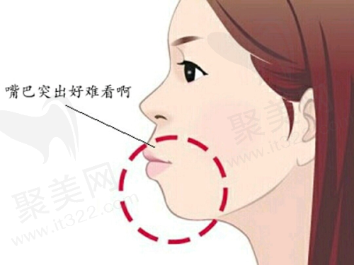 杨俊斐医生擅长项目