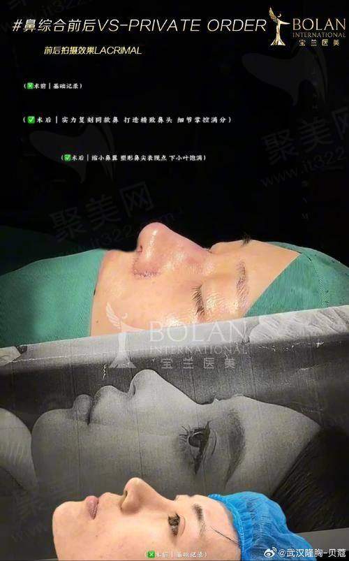 成都周柯做修复鼻怎么样——行业口碑与评价