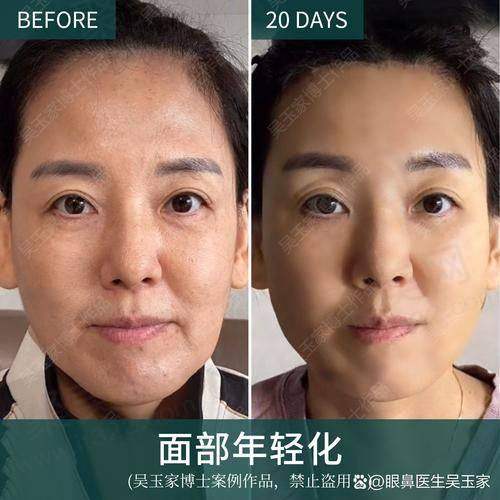 七、汪树杰真实的患者评价