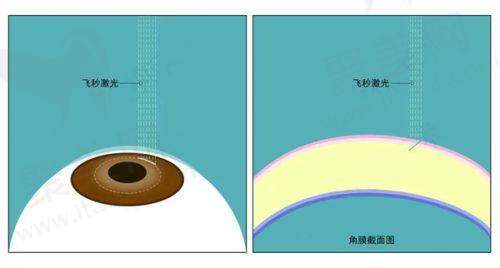 东莞虎门爱尔眼科：区域分院的特色