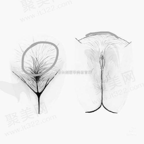 五、治疗前后注意事项