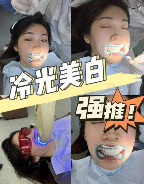 西安团圆口腔医院冷光美白三次套餐治疗流程是怎样的？