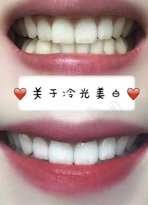西安团圆口腔医院冷光美白三次套餐医院实力如何？
