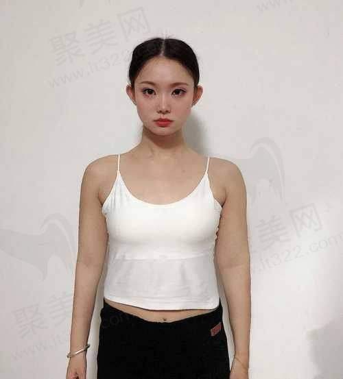 杭州彭涛吸脂医生真实实例靠谱吗？价格与口碑是参考