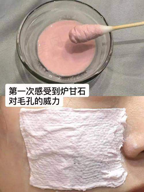 五、毛孔粗大激光治疗的费用
