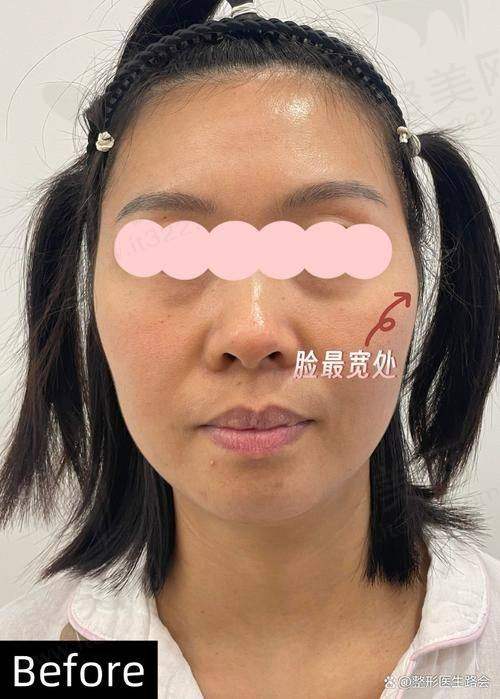 上海首尔丽格医疗美容医院收费标准参考