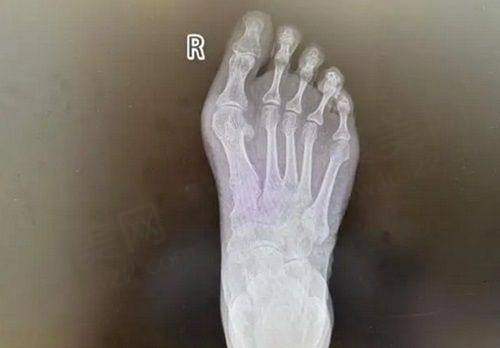 蔡灵医生预约方式