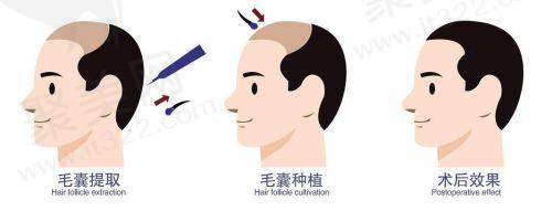 四、广州荔医整形医院价格贵不贵：合理价格超贴心