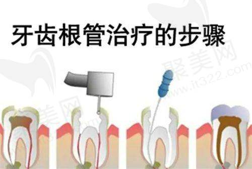 宁波牙博士口腔其他口腔项目收费标准参考