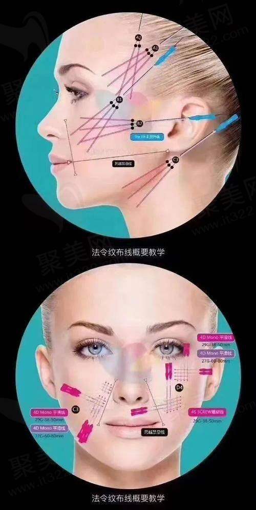 重庆星荣整形快翎线苹果肌埋线提升医生团队