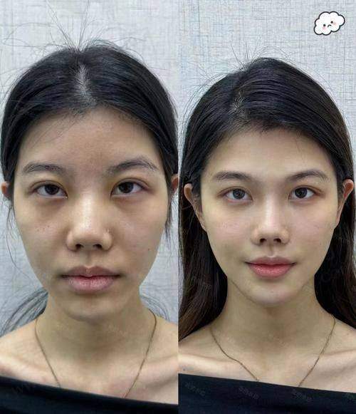 五、美白注意事项