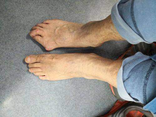 总结