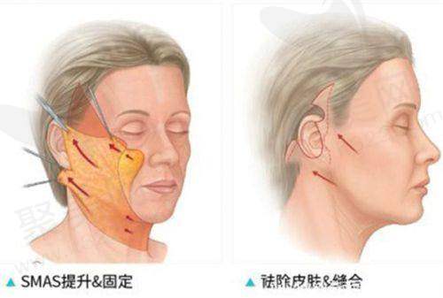 三、惠州整形医院项目收费情况