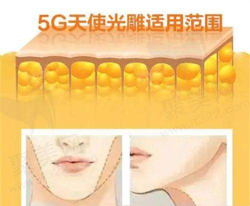 六、医生收费标准：透明和合理
