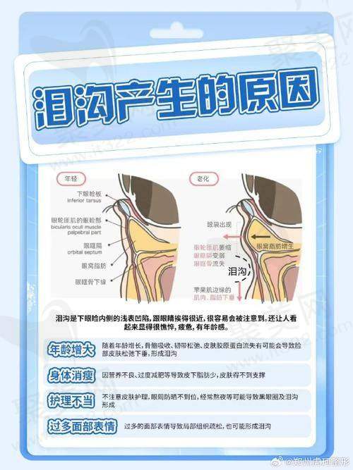 七、眼部泪沟填充之日常保养辅助