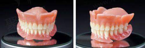 上海鼎植口腔连锁价格表中镶牙与修复项目费用怎样？