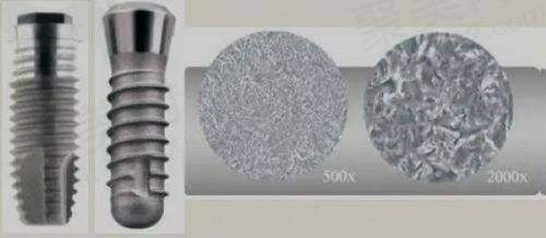 上海鼎植口腔连锁价格表中牙齿矫正项目收费多少？