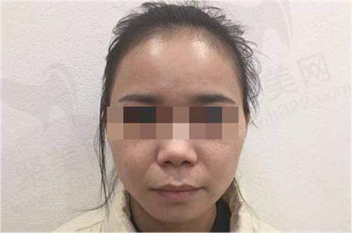 曾宁医生收费价格