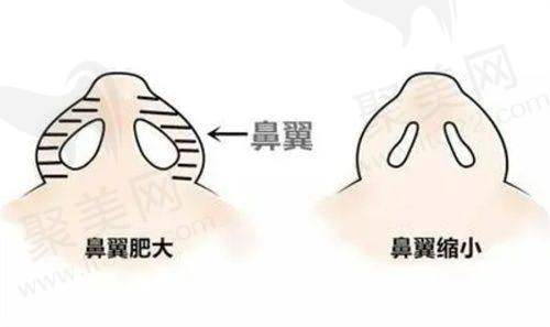 王晓敏医生收费价格