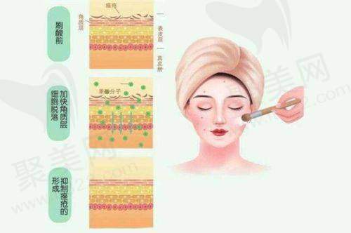 曾宁医生特色技术优势
