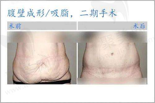 沈阳杏林赵迪：受主播艺人青睐的隆鼻能手