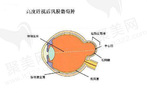 青岛福柏眼科医院地址电话：