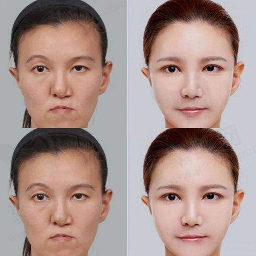 四、上海绿之星医疗美容门诊部怎么预约：