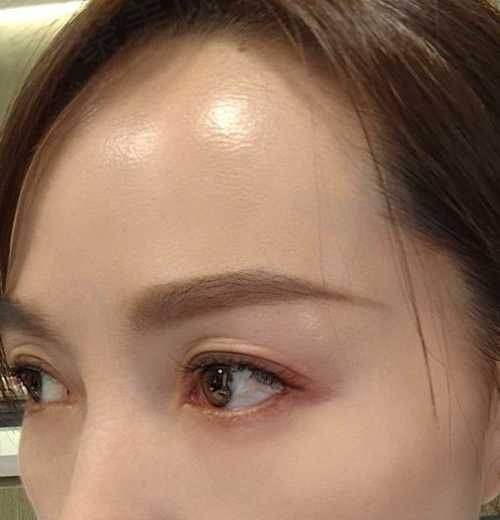 杭州浮想国医疗美容收费标准参考