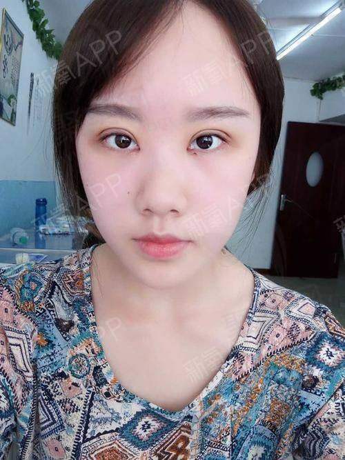 金钟圭医生做擅长项目怎么样？