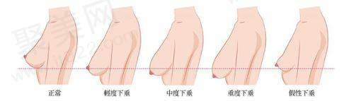 镇江友谊整形外科医院收费价格表