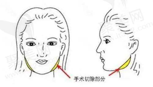 总结