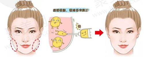 三、深圳非凡整形医院精良设备