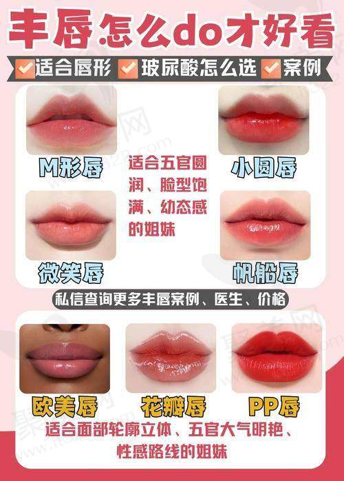 广州荔医医美姣兰玻尿酸1mL嘟嘟唇技术有哪些优势?