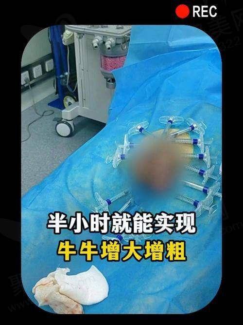 男科增粗增长有成效吗？综合评估提升成效