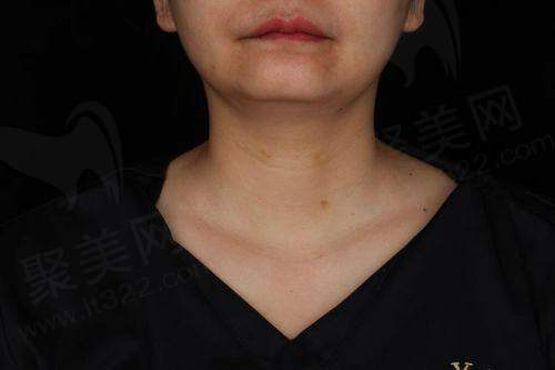 广州荔医医美实力如何?