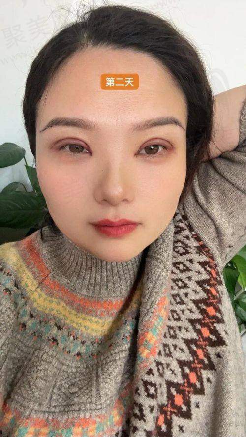 南宁亚太陈晓君医生简介