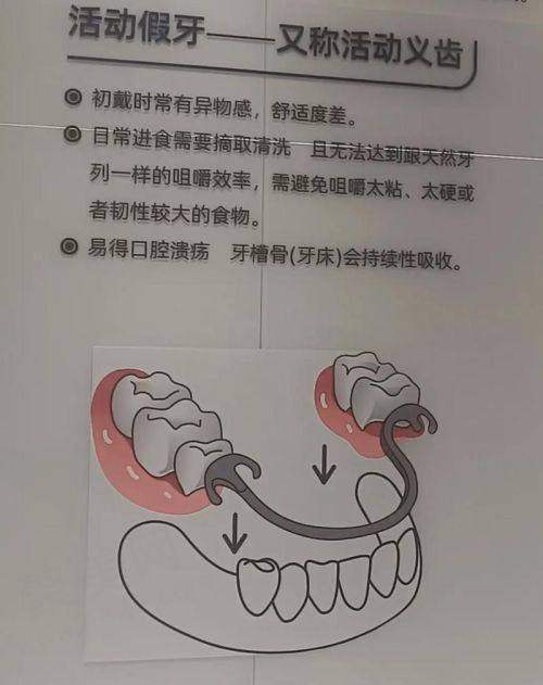 长春传阳口腔老人全口假牙限时优惠力度空前