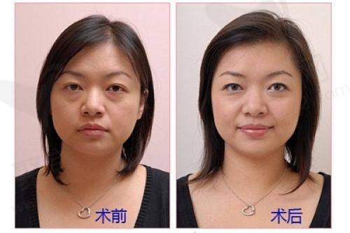 六、徐州和平妇产医院医疗美容科价格表
