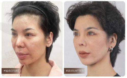 南京美莱整形更厉害三个科室之皮肤美容科能提供什么服务？